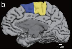 Foto: Una resonancia magnética muestra la ubicación (en amarillo) del área motora suplementaria (SMA). / Yuka Sasaki | Universidad de Brown.